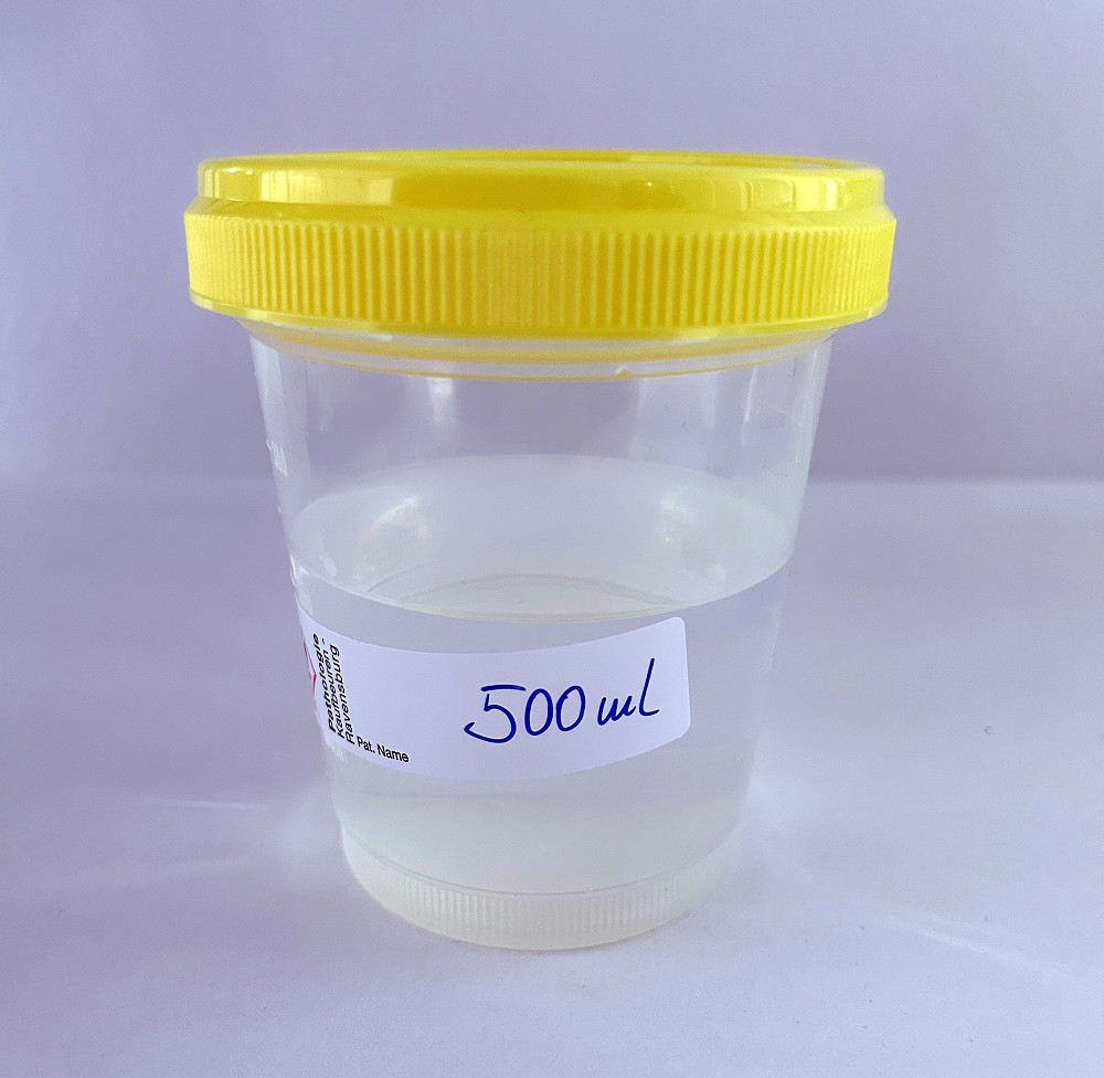 Gefäß Container 500 ml gefüllt